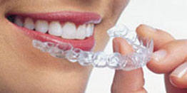 Tooth Whitening